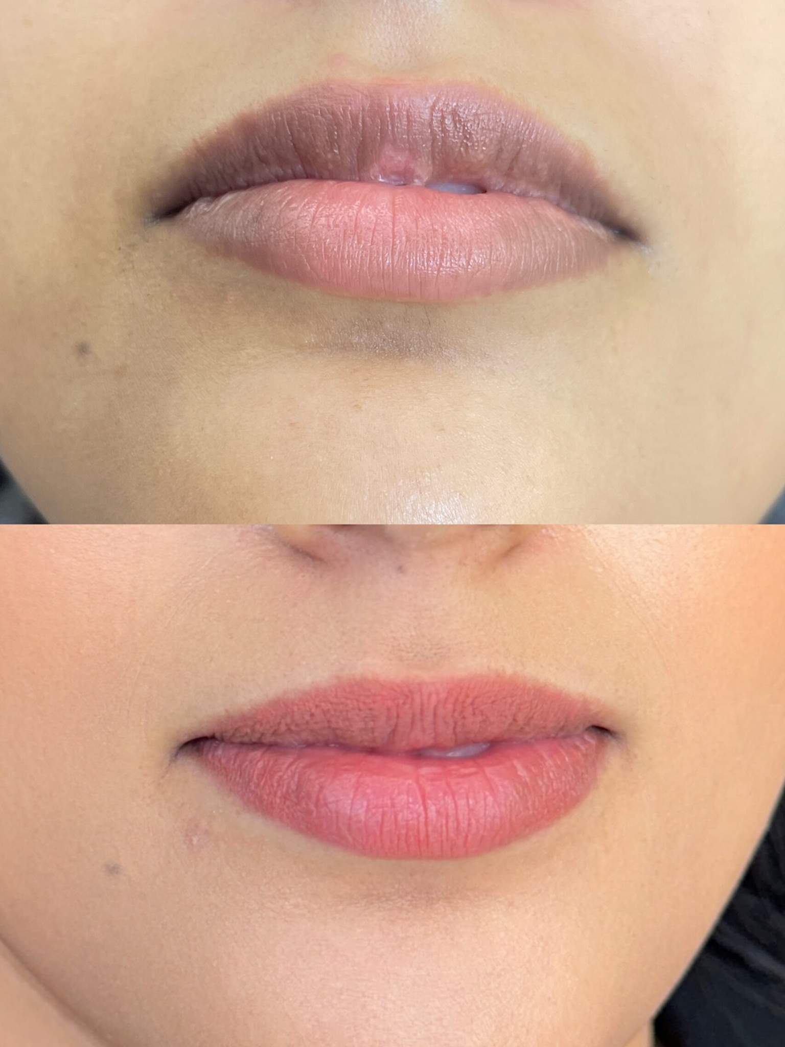 Tes-Lips-scaled 1